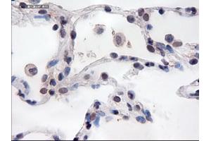 Immunohistochemical staining of paraffin-embedded lung using anti-PECAM1 (TA000121) mouse monoclonal antibody. (CD31 Antikörper  (AA 425-591))