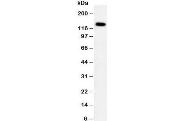 Patched 2 Antikörper  (C-Term)