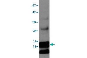 Western blot on ENHO overexpression lysate with ENHO polyclonal antibody . (ENHO Antikörper  (AA 10-60))
