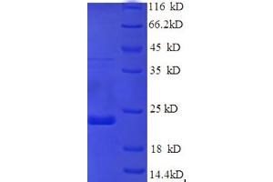 SDS-PAGE (SDS) image for Sex Determining Region Y (SRY) (AA 1-144), (partial) protein (His tag) (ABIN5710418)