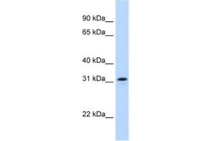 Western Blotting (WB) image for anti-MKI67 FHA Domain-Interacting Nucleolar Phosphoprotein (MKI67IP) antibody (ABIN2462317) (NIFK Antikörper)