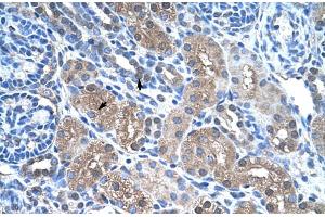 Immunohistochemistry (IHC) image for anti-Fructose-1,6-Bisphosphatase 1 (FBP1) (N-Term) antibody (ABIN2776794)