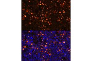 Immunofluorescence analysis of mouse spleen using CLEC4D Rabbit pAb (ABIN3016482, ABIN3016483, ABIN3016484 and ABIN6219759) at dilution of 1:100 (40x lens). (CLEC4D Antikörper  (AA 39-215))