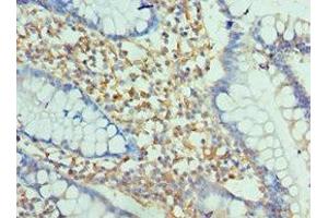 Immunohistochemistry of paraffin-embedded human small intestine tissue using ABIN7151389 at dilution of 1:100 (ENPP2 Antikörper  (AA 564-863))