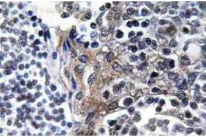 Immunohistochemistry (IHC) analyzes of VASP antibody in paraffin-embedded human tonsil tissue. (VASP Antikörper  (pSer157))