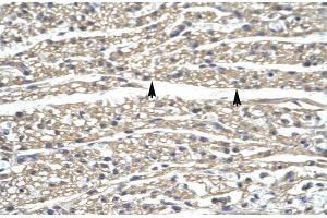 Human Heart; ZNF336 antibody - N-terminal region in Human Heart cells using Immunohistochemistry (ZNF336 Antikörper  (N-Term))