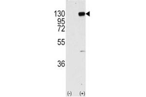 Western Blotting (WB) image for anti-Fibroblast Growth Factor Receptor 1 (FGFR1) (AA 744-773) antibody (ABIN3030940)