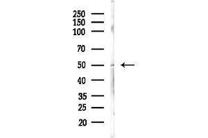 anti-gamma-aminobutyric Acid (GABA) A Receptor, beta 3 (GABRB3) (Internal Region) antibody