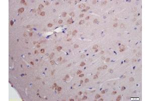 Formalin-fixed and paraffin embedded rat brain labeled with Rabbit Anti-RNA polymerase II CTD repeat YSPTSPS (Ser2) Polyclonal Antibody, Unconjugated (ABIN718391) at 1:200 followed by conjugation to the secondary antibody and DAB staining (RNA Polymerase 2 (pSer2) Antikörper)