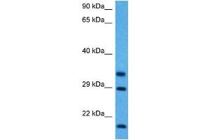 Host:  Mouse  Target Name:  FHL1  Sample Tissue:  Mouse Skeletal Muscle  Antibody Dilution:  1ug/ml (FHL1 Antikörper  (C-Term))