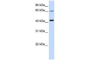 WB Suggested Anti-QPCTL Antibody Titration:  0. (QPCTL Antikörper  (Middle Region))