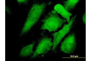 Immunofluorescence of monoclonal antibody to MAPK12 on HeLa cell. (MAPK12 Antikörper  (AA 251-367))