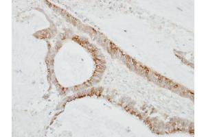 IHC-P Image Immunohistochemical analysis of paraffin-embedded TW2. (CMTM6 Antikörper  (C-Term))