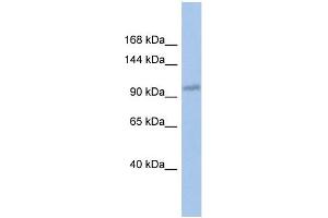 WB Suggested Anti-DDX24 Antibody Titration:  0.