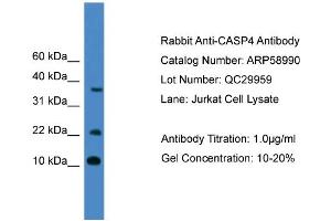 WB Suggested Anti-CASP4  Antibody Titration: 0. (Caspase 4 Antikörper  (Middle Region))