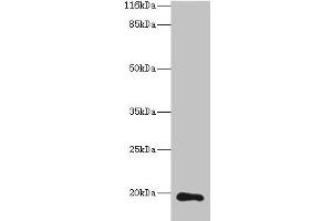Western blot All lanes: RAB30 antibody at 1 μg/mL + Hela whole cell lysate Secondary Goat polyclonal to rabbit IgG at 1/10000 dilution Predicted band size: 24, 19 kDa Observed band size: 19 kDa (RAB3A Antikörper  (AA 1-200))