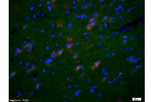 Formalin-fixed and paraffin-embedded rat brain labeled with Anti-GluR1/AMPA Polyclonal Antibody, Unconjugated (ABIN1385842) 1:200, overnight at 4°C, The secondary antibody was Goat Anti-Rabbit IgG, Cy3 conjugated used at 1:200 dilution for 40 minutes at 37°C. (GluR1, GluR2 Antikörper  (AA 141-240))