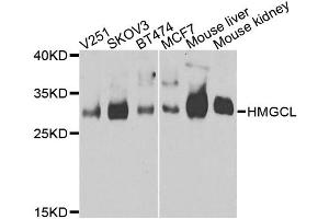 Western blot analysis of extracts of various cell lines, using HMGCL antibody.