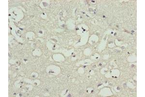 Immunohistochemistry of paraffin-embedded human brain tissue using ABIN7165213 at dilution of 1:100 (CNIH3 Antikörper  (AA 94-138))