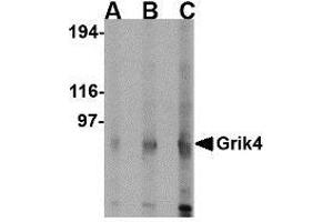 Western blot analysis of Grik4 in rat brain lysate with Grik4 antibody at (A) 0. (GRIK4 Antikörper  (C-Term))