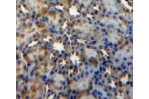 Used in DAB staining on fromalin fixed paraffin-embedded kidney tissue (SOCS3 Antikörper  (AA 1-225))