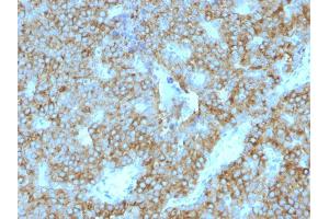 Formalin-fixed, paraffin-embedded human Parathyroid Gland stained with PTH Mouse Monoclonal Antibody (PTH/1175). (PTH Antikörper  (AA 32-115))