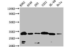 Western Blot Positive WB detected in: K562 whole cell lysate,A549 whole cell lysate,293 whole cell lysate,U251 whole cell lysate,HL-60 whole cell lysate,Hela whole cell lysate All lanes: VDAC3 antibody at 1:1000 Secondary Goat polyclonal to rabbit IgG at 1/50000 dilution Predicted band size: 31 kDa Observed band size: 32 kDa