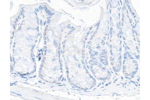 Immunohistochemistry (IHC) image for anti-Tripartite Motif Containing 24 (TRIM24) (AA 700-750) antibody (ABIN7454678) (TRIM24 Antikörper  (AA 700-750))