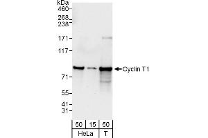 Western Blotting (WB) image for anti-Cyclin T1 (CCNT1) (AA 425-475) antibody (ABIN7453624)