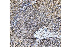 IHC analysis of TIGD1 using anti-TIGD1 antibody (ABIN7602407). (TIGD1 Antikörper  (AA 74-591))