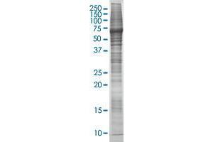 CDC2L5 transfected lysate