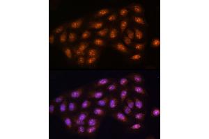 Immunofluorescence analysis of U2OS cells using [KO Validated] PPP1CC Rabbit pAb (ABIN1682257, ABIN3018437, ABIN3018438 and ABIN5664595) at dilution of 1:100 (40x lens). (PPP1CC Antikörper  (AA 1-323))