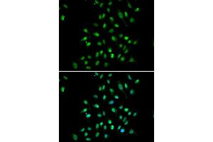 Immunofluorescence analysis of A549 cells using CXXC1 antibody.