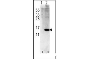 Image no. 1 for anti-ISG15 Ubiquitin-Like Modifier (ISG15) (Middle Region) antibody (ABIN356681) (ISG15 Antikörper  (Middle Region))