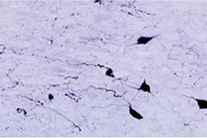 Immunohistochemical staining of HCRTR1 in rat zona incerta neurons using HCRTR1 polyclonal antibody , at a dilution of 1 : 1000. (HCRTR1 Antikörper  (AA 12-33))