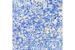 Immunohistochemistry of paraffin-embedded mouse spleen using Filamin A antibody (ABIN7267206) at dilution of 1:100 (40x lens). (Filamin A Antikörper  (C-Term))