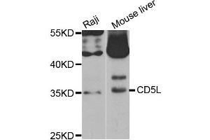 Western Blotting (WB) image for anti-CD5 Molecule-Like (CD5L) antibody (ABIN1882350) (CD5L Antikörper)