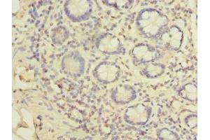 Immunohistochemistry of paraffin-embedded human small intestine tissue using ABIN7151342 at dilution of 1:100