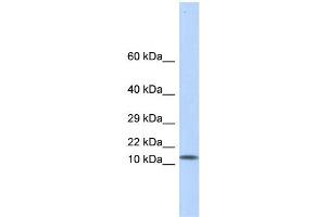 WB Suggested Anti-LGALS1 Antibody Titration: 0. (LGALS1/Galectin 1 Antikörper  (Middle Region))