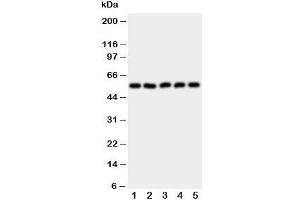 Western blot testing of HYAL2 antibody and Lane 1:  HeLa;  2: SMMC-7721;  3: COLO320;  4: MCF-7;  5: HT1080 cell lysate