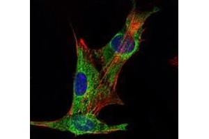 Immunofluorescence analysis of PANC-1 cells using INHA antibody (green). (Inhibin alpha Antikörper)