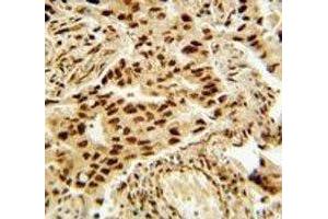 Immunohistochemistry (IHC) image for anti-Histone Deacetylase 2 (HDAC2) (AA 410-439) antibody (ABIN3031225)