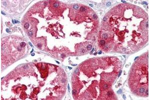 Human Kidney (formalin-fixed, paraffin-embedded) stained with PLXDC1 antibody ABIN351450 at 5 ug/ml followed by biotinylated goat anti-rabbit IgG secondary antibody ABIN481713, alkaline phosphatase-streptavidin and chromogen. (PLXDC1 Antikörper  (Internal Region))