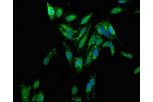 Immunofluorescence staining of Hela cells with ABIN7142604 at 1:100, counter-stained with DAPI. (AZI2 Antikörper  (AA 258-376))