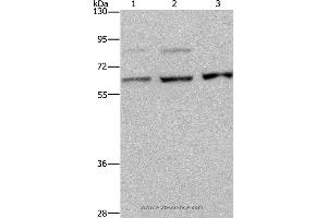 Western blot analysis of A431, MCF-7 and Hela cell, using KIF22 Polyclonal Antibody at dilution of 1:200 (KIF22 Antikörper)