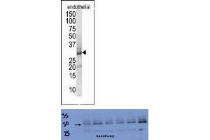 TOP: The anti-DSCR1 Pab is used in Western blot to detect DSCR1 in endothelial cell lysate. (RCAN1 Antikörper  (Middle Region))
