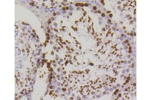 Paraformaldehyde-fixed, paraffin embedded mouse testis, Antigen retrieval by boiling in sodium citrate buffer (pH6) for 15min, Block endogenous peroxidase by 3% hydrogen peroxide for 30 minutes, Blocking buffer at 37°C for 20min, Antibody incubation with Histone H2A. (H2AFX Antikörper  (pSer139))