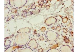 Immunohistochemistry of paraffin-embedded human thyroid tissue using ABIN7170586 at dilution of 1:100 (SPICE1 Antikörper  (AA 1-220))