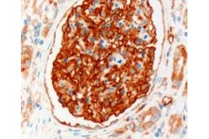 Immunohistochemistry (IHC) image for anti-Solute Carrier Family 9 (Sodium/hydrogen Exchanger), Member 3 Regulator 2 (SLC9A3R2) (Internal Region) antibody (ABIN185496)