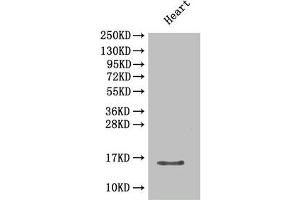 Western Blot Positive WB detected in: Mouse heart tissue All lanes: Cxcl5 antibody at 2 μg/mL Secondary Goat polyclonal to rabbit IgG at 1/50000 dilution Predicted band size: 15 kDa Observed band size: 15 kDa (CXCL5 Antikörper  (AA 46-117))